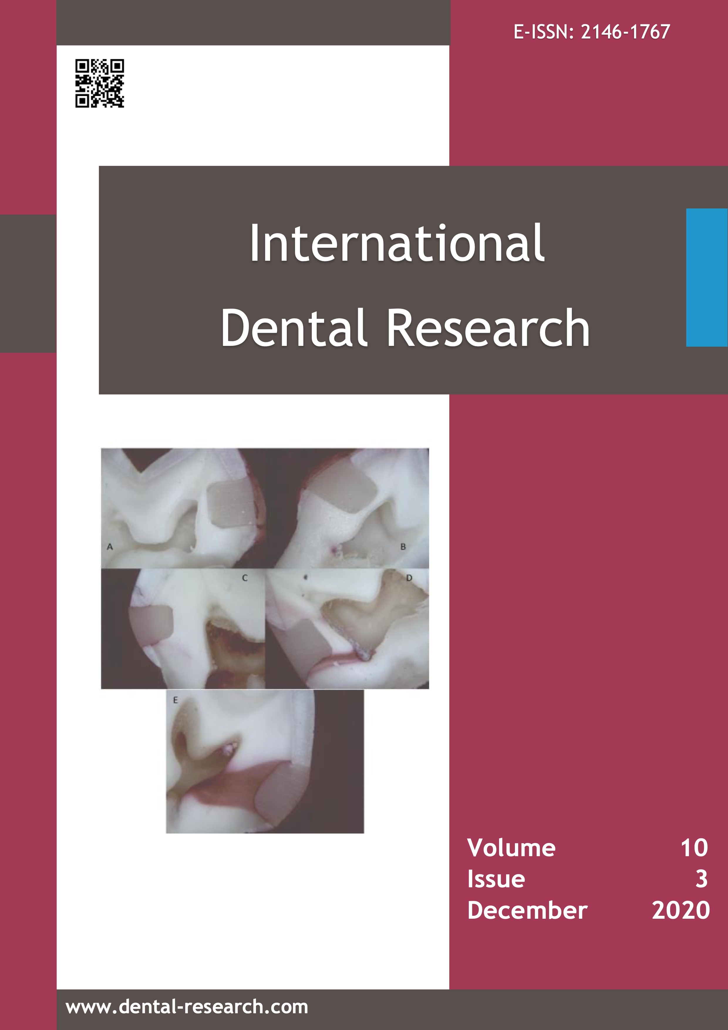 Vol 10 No 3 (2020): International Dental Research