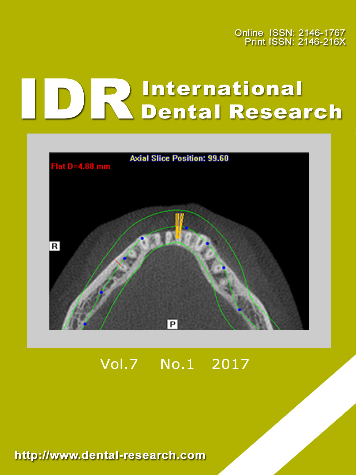 					View Vol. 7 No. 1 (2017): International Dental Research
				