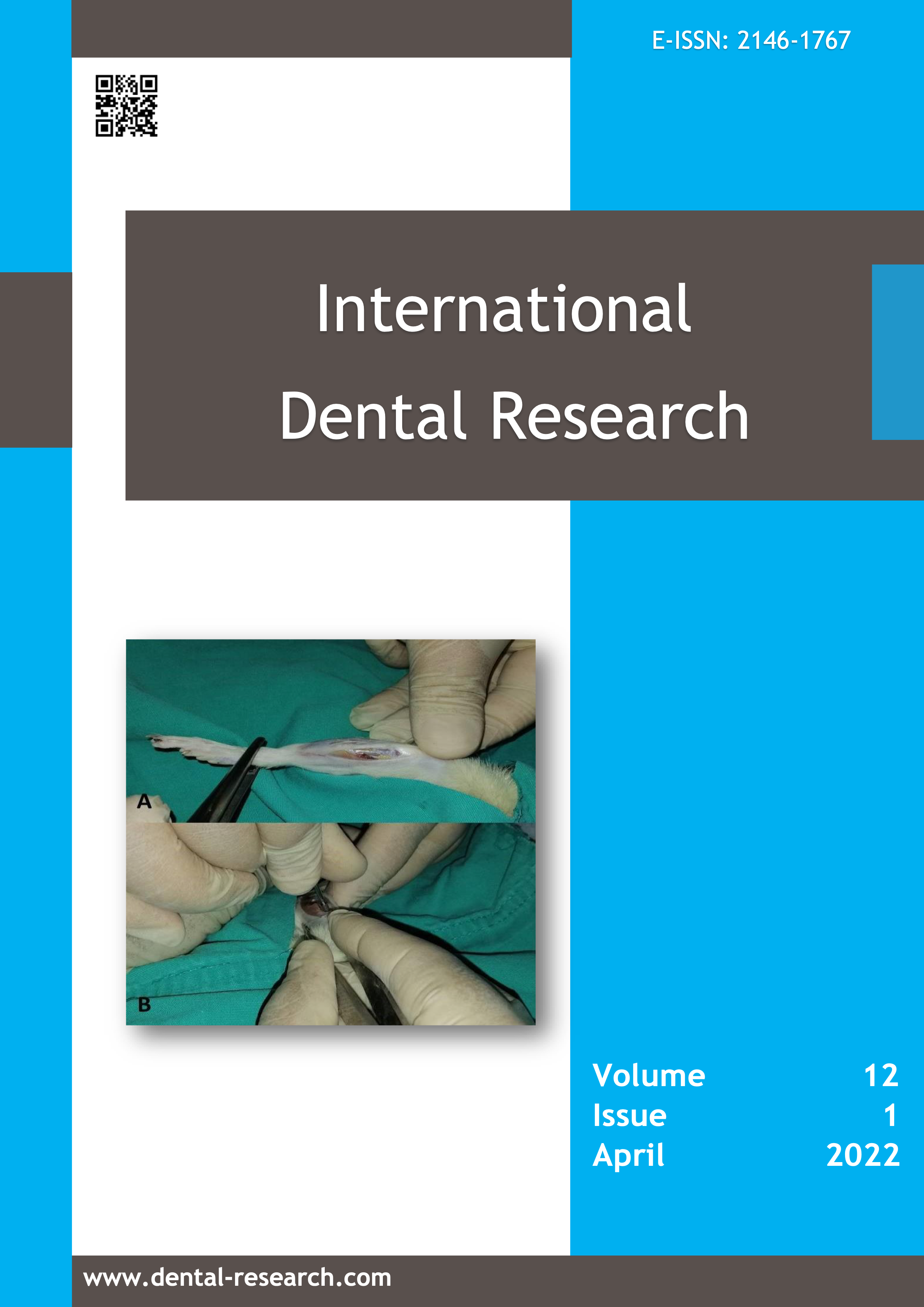 					View Vol. 12 No. 1 (2022): International Dental Research
				