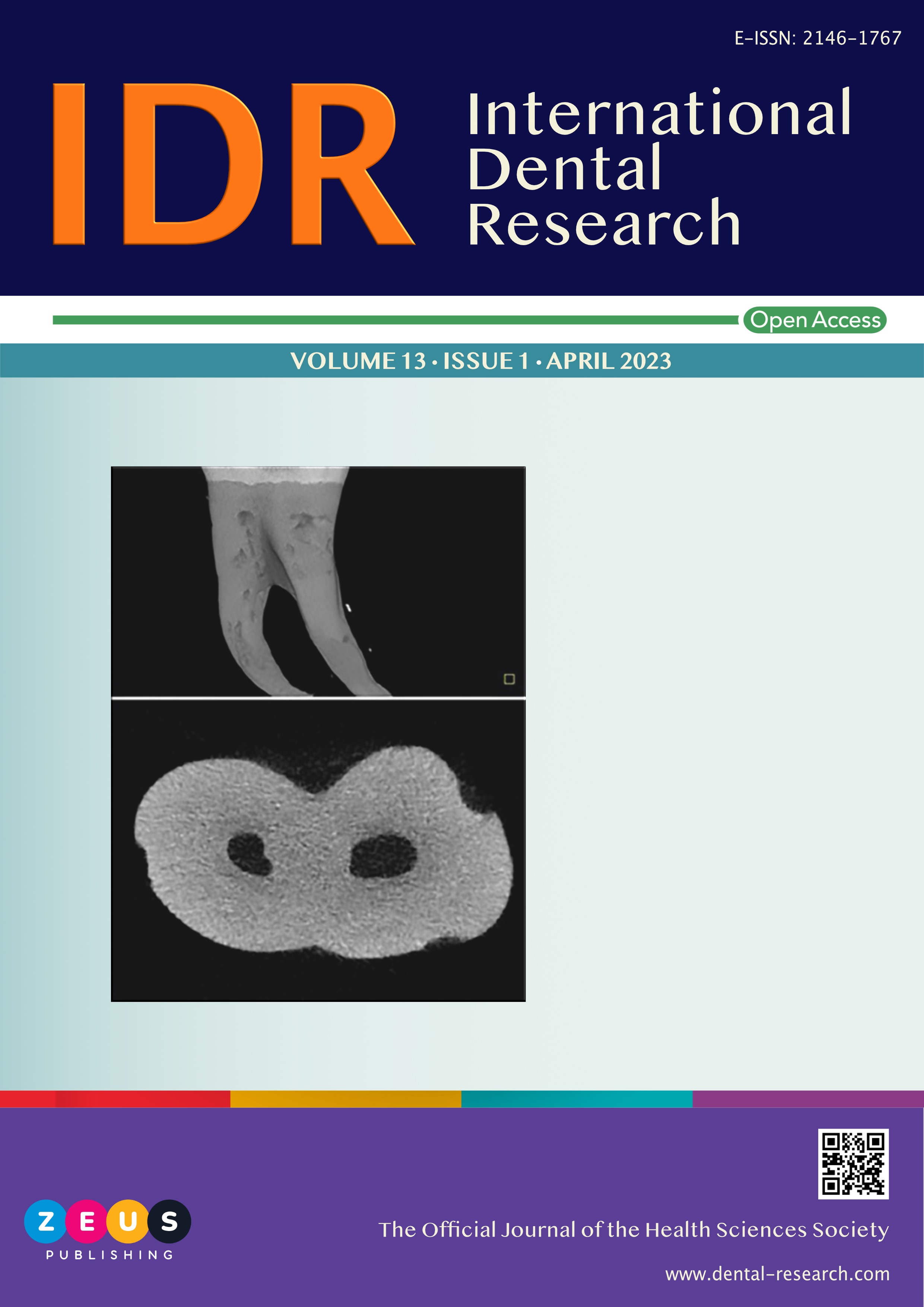 					View Vol. 13 No. 1 (2023): International Dental Research
				